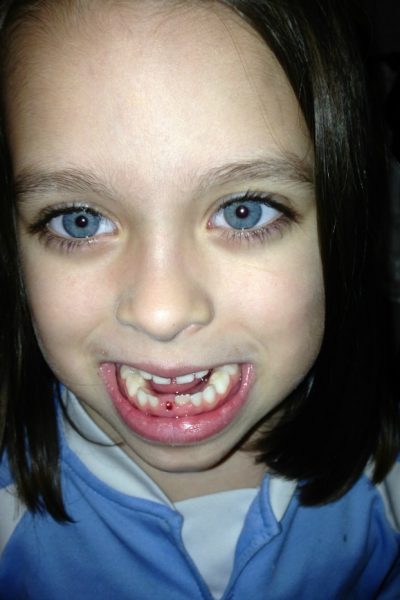 tooth fairy