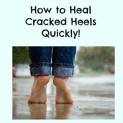 heal cracked heals